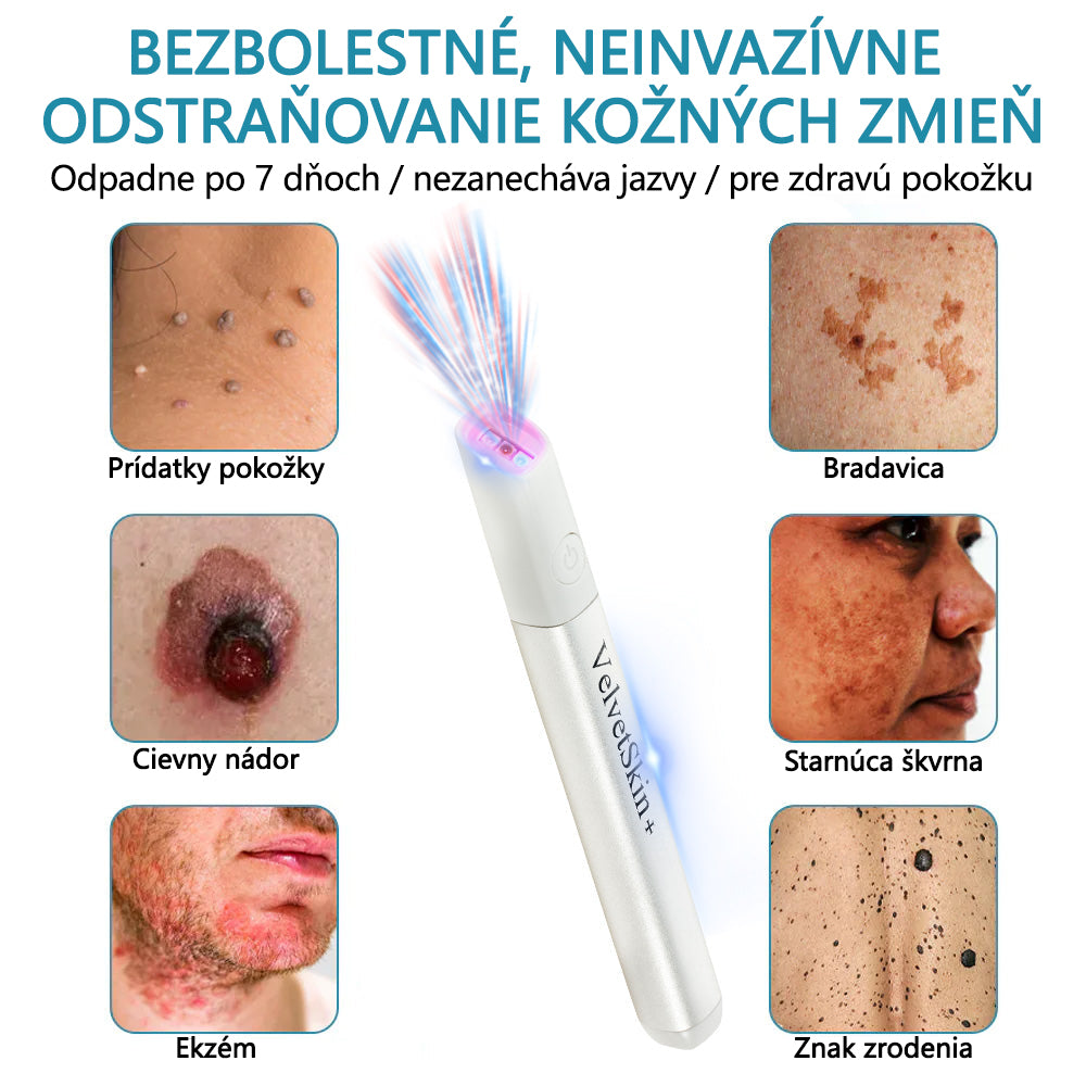 ✨ Bikenda® – CO₂ laserové pero na odstraňovanie 🟤 materských znamienok, 🦠 bradavíc, 🔘 škvŕn a iných nedokonalostí pleti💄