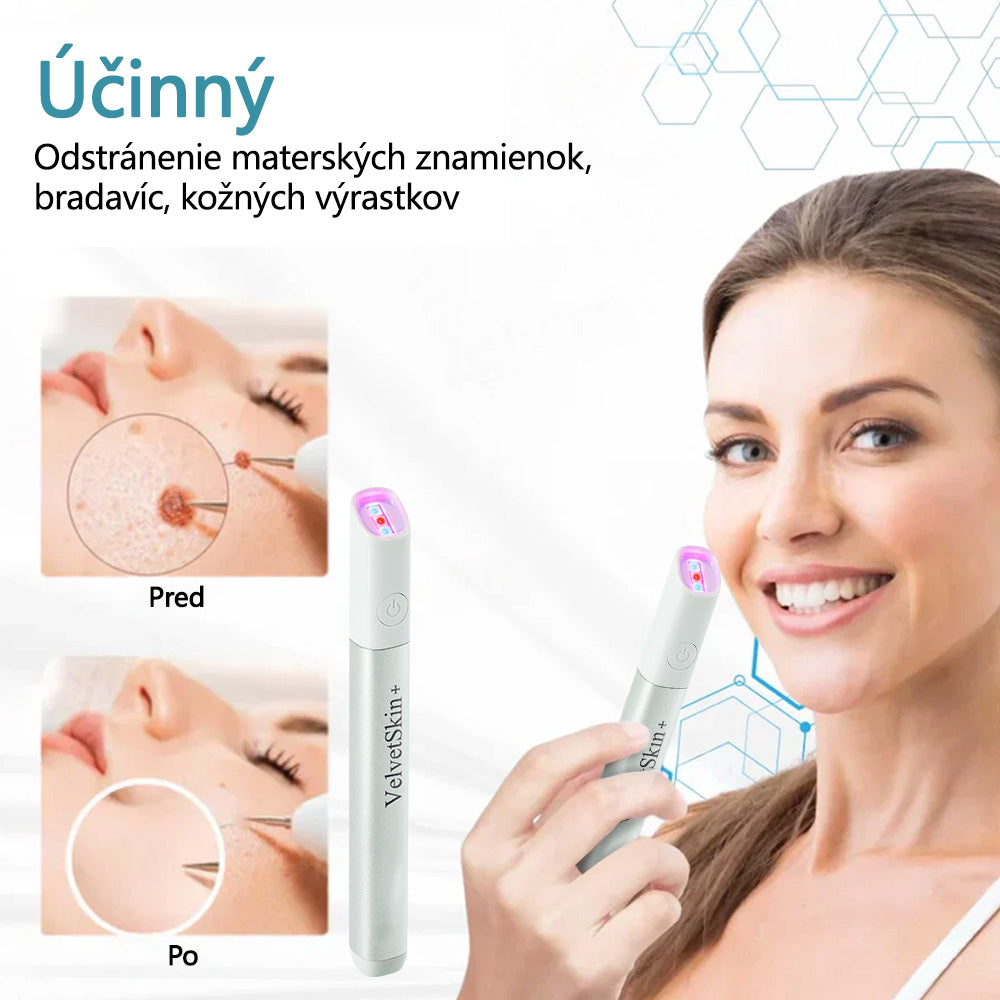 ✨ Bikenda® – CO₂ laserové pero na odstraňovanie 🟤 materských znamienok, 🦠 bradavíc, 🔘 škvŕn a iných nedokonalostí pleti💎