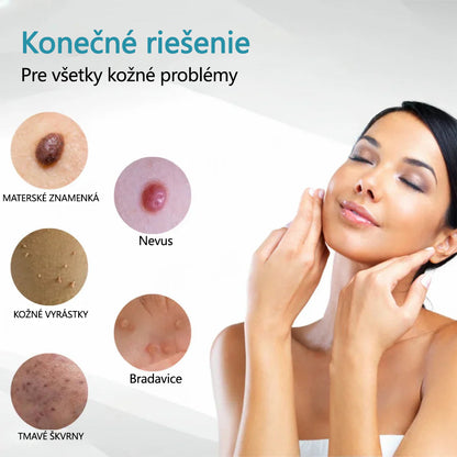 ✨ Bikenda® – CO₂ laserové pero na odstraňovanie 🟤 materských znamienok, 🦠 bradavíc, 🔘 škvŕn a iných nedokonalostí pleti💎
