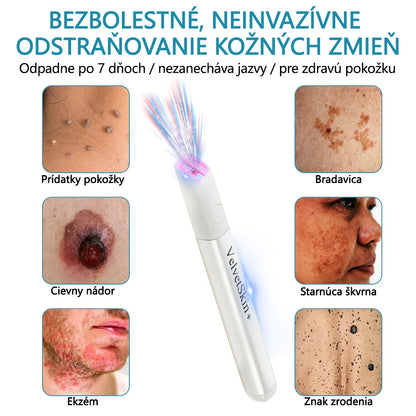 ✨ Bikenda® – CO₂ laserové pero na odstraňovanie 🟤 materských znamienok, 🦠 bradavíc, 🔘 škvŕn a iných nedokonalostí pleti💎