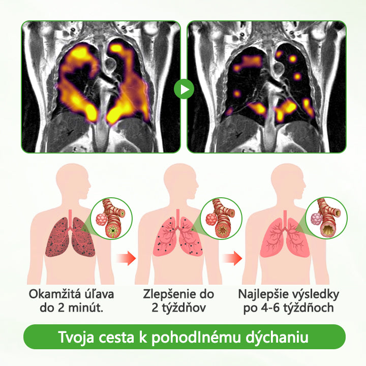 Timilk® Divozel na čistenie pľúc️🟧🔶