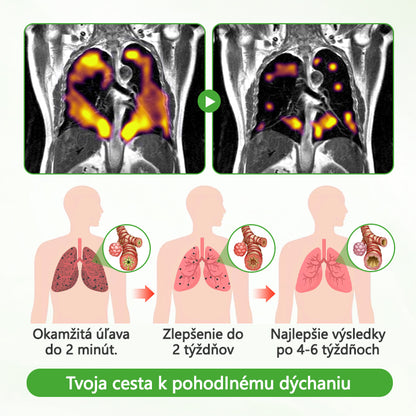 Timilk® Divozel na čistenie pľúc️🟧🔶